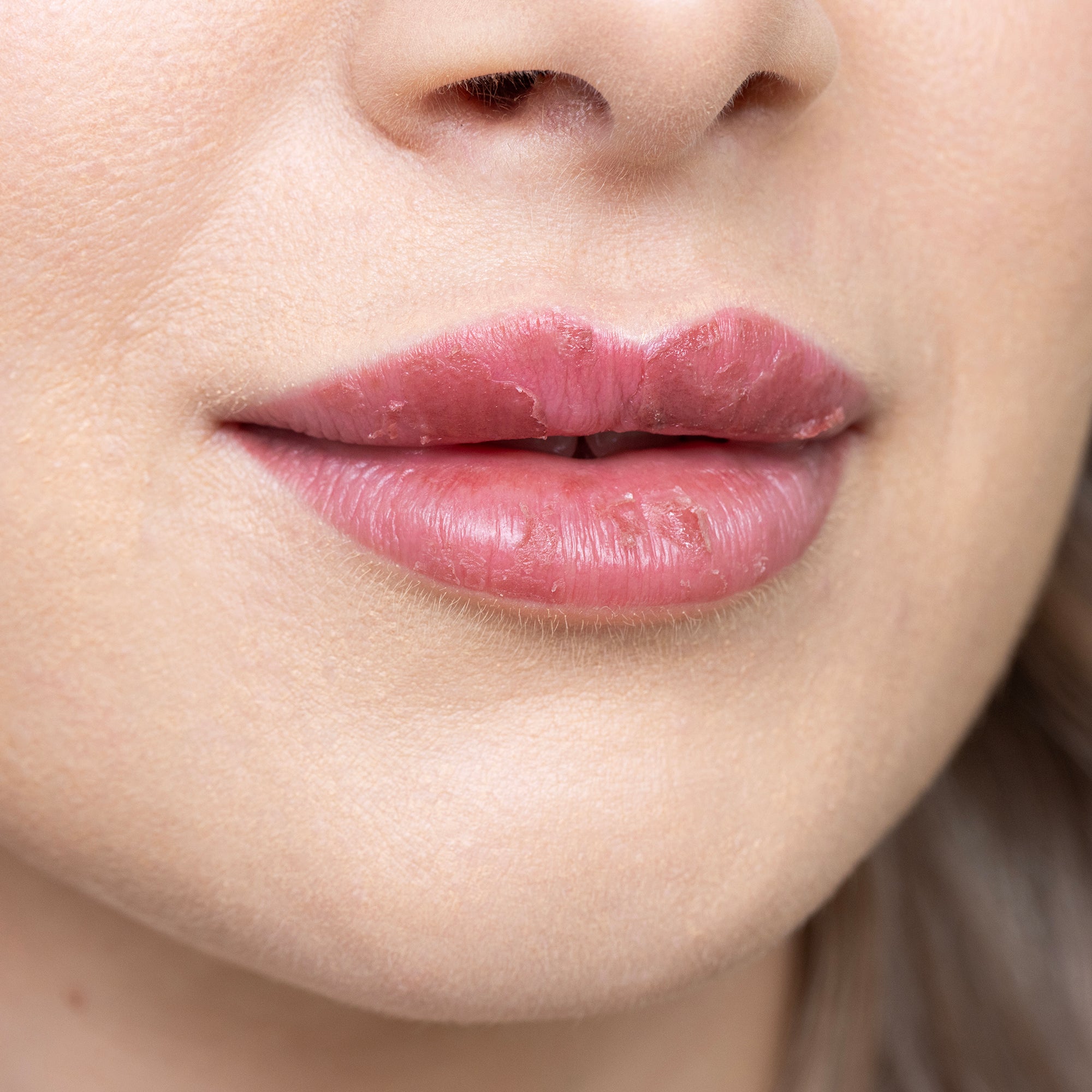 Hojící se rty po permanentním make-upu technikou lip blush